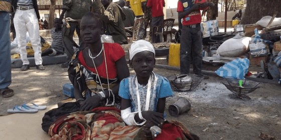 A wounded child sits next to a relative after receiving treatment at the Malakal Hospital in the Upper Nile State of South Sudan on December 31, 2013 following heavy fighting in the the past few days. (SAMIR BOL/AFP/Getty) 