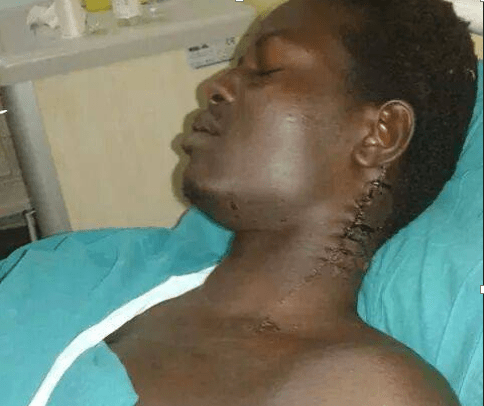 Deng Ayok photo showing how he was cuts and tortured in Cairo