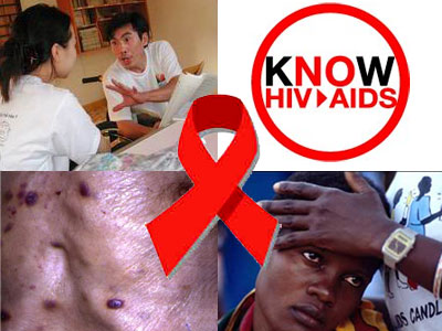 hiv-aids2